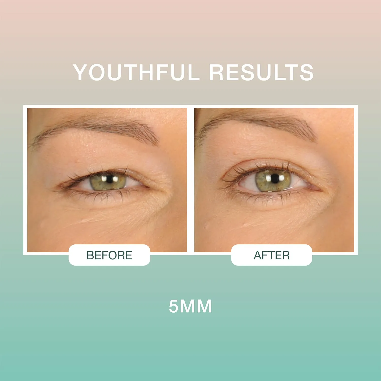 Contours Rx Lids by Design - Non-Surgical & Transparent Eyelid Lift Strips - for a More Youthful-Looking Appearance, Lid Lifting Treatment, Eyelid Tape for Hooded Eyes (5mm)160ct
